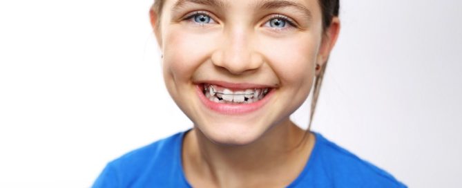 Why Do I need Orthodontics Perla Dental Care, Hurghada