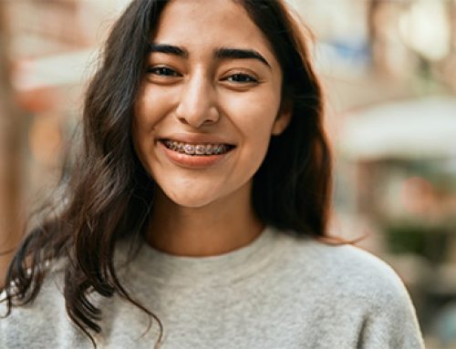 Orthodontic Tightening in Hurghada Keeps Braces on Track