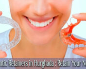Orthodontic Retainers in Hurghada : Retain Your New Smile
