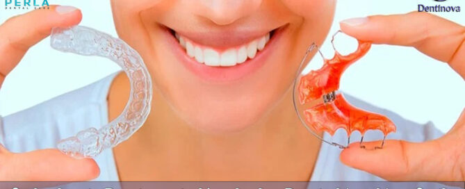 Orthodontic Retainers in Hurghada : Retain Your New Smile