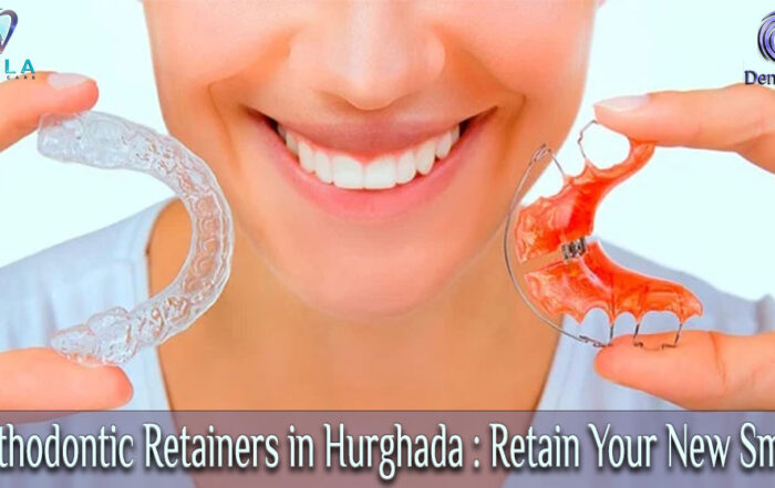 Orthodontic Retainers in Hurghada : Retain Your New Smile